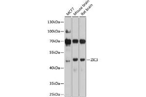 Western blot analysis of extracts of various cell lines, using ZIC3 antibody (ABIN6133228, ABIN6150444, ABIN6150446 and ABIN6225011) at 1:1000 dilution. (ZIC3 anticorps  (AA 1-240))