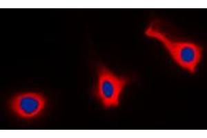 Immunofluorescent analysis of CD9 staining in HEK293T cells. (CD9 anticorps  (Center))