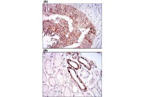 Immunohistochemical staining of human ovarian cancer tissues (A) and kidney tissues (B) with TIE1 monoclonal antibody, clone 8D12D2  at 1:200-1:1000 dilution.