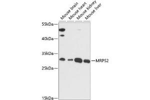 Western blot analysis of extracts of various cell lines, using MRPS2 antibody (ABIN7268584) at 1:3000 dilution. (MRPS2 anticorps  (AA 1-296))