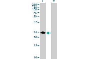 Western Blot analysis of ZNF486 expression in transfected 293T cell line by ZNF486 MaxPab polyclonal antibody. (ZNF486 anticorps  (AA 1-216))