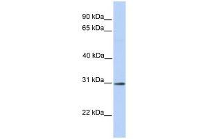 WB Suggested Anti-RNF148 Antibody Titration:  0. (RNF148 anticorps  (C-Term))