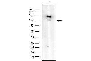 Western blot analysis of lysates from COLO205 cells, using Phospho-IKK beta (Tyr188) Mouse Monoclonal Antibody at 1/1000 dilution.