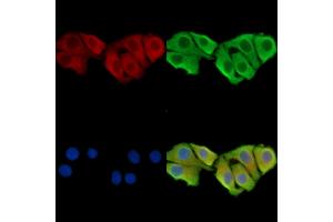 ABIN7095364 and ABIN7099421 staining Hela cells by IF/ICC. (WDR76 anticorps)