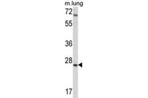 Western blot analysis of IGFBP4 Antibody (N-term) in mouse lung tissue lysates (35ug/lane). (IGFBP4 anticorps  (N-Term))