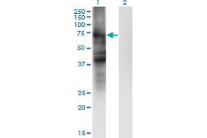 Western Blot analysis of SLC4A4 expression in transfected 293T cell line by SLC4A4 monoclonal antibody (M01), clone 1G2. (SLC4A4 anticorps  (AA 1-646))