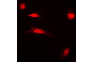 Immunofluorescent analysis of Histone H3 (AcK27) staining in HeLa cells.