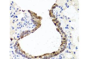 Immunohistochemistry of paraffin-embedded Rat lung using TOPBP1 Polyclonal Antibody at dilution of 1:100 (40x lens). (TOPBP1 anticorps)