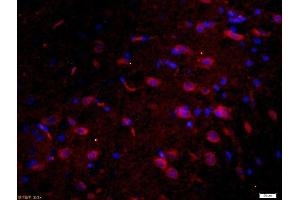 Paraformaldehyde-fixed, paraffin embedded rat brain, Antigen retrieval by boiling in sodium citrate buffer (pH6) for 15min, Block endogenous peroxidase by 3% hydrogen peroxide for 30 minutes, Blocking buffer (normal goat serum) at 37°C for 20min, Antibody incubation with 	Tau protein Polyclonal Antibody, Unconjugated  at 1:200 overnight at 4°C, followed by a conjugated secondary Goat Anti-Rabbit IgG, Cy3 conjugated-Cy3)used at 1:200 dilution for 40 minutes at 37°C.