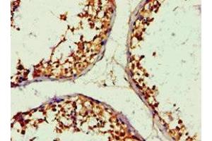 Immunohistochemistry of paraffin-embedded human testis tissue using ABIN7143676 at dilution of 1:100 (ALDH1B1 anticorps  (AA 278-517))