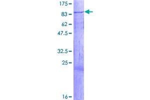 Image no. 1 for Insulin-Like Growth Factor 2 mRNA Binding Protein 2 (IGF2BP2) (AA 1-598) protein (GST tag) (ABIN1307555)