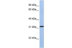 Western Blotting (WB) image for anti-Solute Carrier Family 25, Member 28 (SLC25A28) antibody (ABIN2458805) (SLC25A28 anticorps)