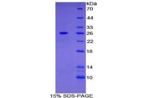 SDS-PAGE (SDS) image for Adenylate Cyclase 6 (ADCY6) (AA 246-435) protein (His tag) (ABIN2123936)