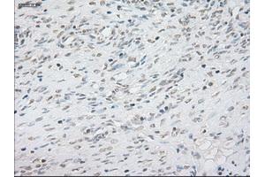 Immunohistochemical staining of paraffin-embedded lung tissue using anti-NEUROG1mouse monoclonal antibody. (Neurogenin 1 anticorps)