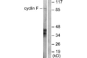 Western blot analysis of extracts from HeLa cells, using Cyclin F antibody (#C0168). (Cyclin F anticorps)