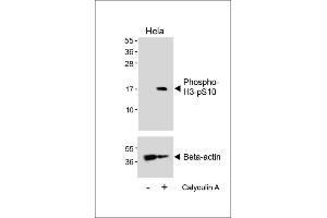 Western blot analysis of lysates from Hela cell line, untreated or treated with 20 % FBS + 100nM Calyculin A, using Phospho-HIST1H3B3(S10) Antibody (upper) or Beta-actin (lower). (HIST1H3B3 (pSer10) anticorps)
