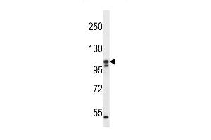 SLC12A6 Antibody (N-term) (ABIN656316 and ABIN2845619) western blot analysis in ZR-75-1 cell line lysates (35 μg/lane).