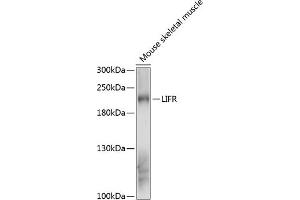 Western blot analysis of extracts of mouse skeletal muscle, using LIFR antibody (ABIN6132110, ABIN6143204, ABIN6143205 and ABIN6216534) at 1:3000 dilution. (LIFR anticorps  (AA 500-700))