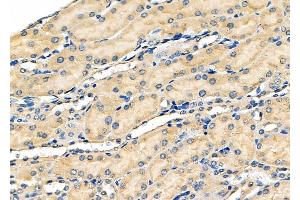 ABIN6259879 and ABIN6278421 at 1/100 staining Mouse kidney tissue by IHC-P. (ALDH3A1 anticorps  (C-Term))