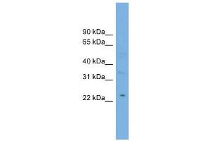 WB Suggested Anti-MBL2 Antibody Titration:  0.