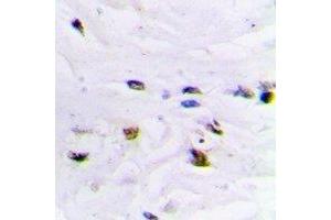 Immunohistochemical analysis of ZNF7 staining in human brain formalin fixed paraffin embedded tissue section. (ZNF7 anticorps  (N-Term))