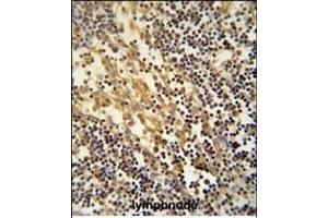 TNFAIP2 Antibody (Center) (ABIN390522 and ABIN2840874) immunohistochemistry analysis in formalin fixed and paraffin embedded human lymphnode followed by peroxidase conjugation of the secondary antibody and DAB staining. (TNFAIP2 anticorps  (AA 456-484))