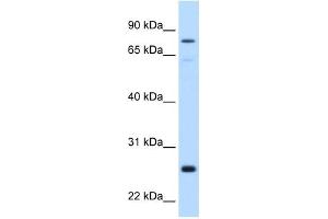 GSTM2 antibody used at 0. (GSTM2 anticorps)