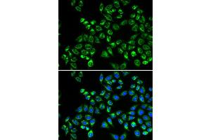 Immunofluorescence analysis of HeLa cells using C1QBP antibody (ABIN5970966). (C1QBP anticorps)