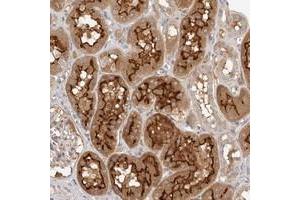 Immunohistochemical staining of human kidney with MICALL2 polyclonal antibody  shows strong cytoplasmic and membrane positivity in cells in tubules. (MICALL2 anticorps)
