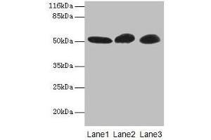 Western blot All lanes: GDI2 antibody at 2 μg/mL Lane 1: Mouse brain tissue Lane 2: HepG2 whole cell lysate Lane 3: MCF-7 whole cell lysate Secondary Goat polyclonal to rabbit IgG at 1/10000 dilution Predicted band size: 51, 46 kDa Observed band size: 51 kDa (GDI2 anticorps  (AA 1-445))