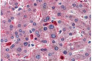 Human Liver: Formalin-Fixed, Paraffin-Embedded (FFPE)