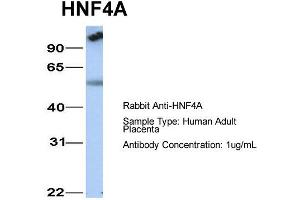 Host: Rabbit  Target Name: HNF4A  Sample Tissue: Human Adult Placenta  Antibody Dilution: 1. (HNF4A anticorps  (N-Term))