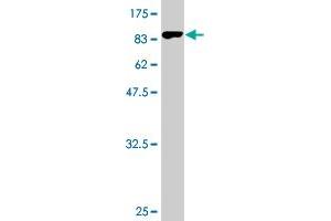 Western Blot detection against Immunogen (82. (UNC5CL anticorps  (AA 1-518))