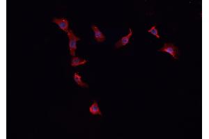 ABIN6268757 staining HepG2 cells by IF/ICC.