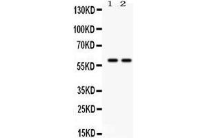 Anti- TH Picoband antibody, Western blotting All lanes: Anti TH  at 0. (TH anticorps  (Middle Region))