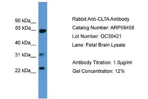 WB Suggested Anti-CLTA  Antibody Titration: 0. (CLTA anticorps  (C-Term))