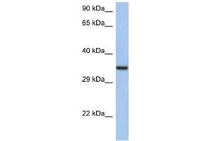 WB Suggested Anti-HORMAD2 Antibody Titration: 0. (HORMAD2 anticorps  (N-Term))