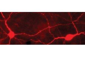 Immunostaining of light-stimulated rabbit retina showing labeling of TH when phosphorylated at Ser40. (Tyrosine Hydroxylase anticorps  (pSer40))