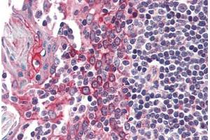 Human Tonsil (formalin-fixed, paraffin-embedded) stained with CSNK1E antibody ABIN337139 at 5 ug/ml followed by biotinylated anti-goat IgG secondary antibody ABIN481715, alkaline phosphatase-streptavidin and chromogen. (CK1 epsilon anticorps  (AA 403-416))
