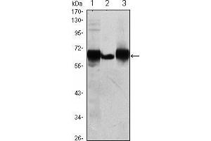 Western blot analysis using ALPP mouse mAb against HepG2 (1), A431 (2) and MCF-7 (3) cell lysate.