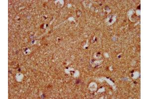 IHC image of ABIN7160821 diluted at 1:400 and staining in paraffin-embedded human brain tissue performed on a Leica BondTM system. (NLRP1 anticorps  (AA 589-655))