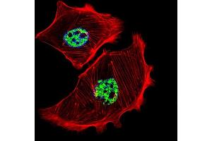 Fluorescent confocal image of SK-BR-3 cell stained with USF1 Antibody (Center) (ABIN655030 and ABIN2844661). (USF1 anticorps  (AA 174-201))