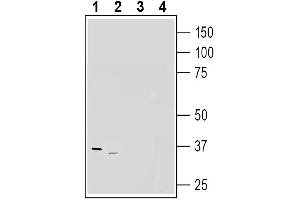 anti-Adenosine A3 Receptor (ADORA3) (AA 149-161), (Extracellular) antibody