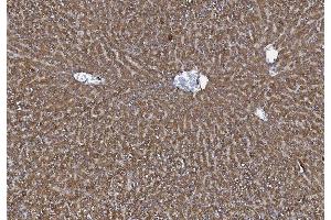 IHC analysis of MTTP using anti-MTTP antibody (ABIN7601145). (MTTP anticorps  (AA 29-702))