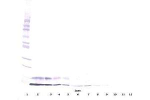 Image no. 1 for anti-Insulin-Like Growth Factor 1 (IGF1) antibody (ABIN464965) (IGF1 anticorps)