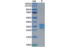 M-CSF/CSF1 Protein (AA 33-190) (His-Avi Tag)