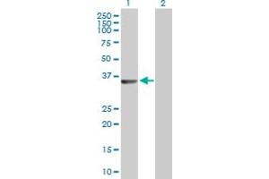 Western Blot analysis of RLBP1 expression in transfected 293T cell line by RLBP1 MaxPab polyclonal antibody. (RLBP1 anticorps  (AA 1-317))