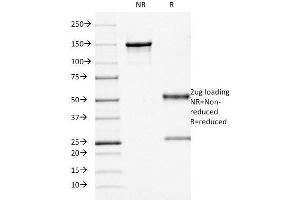 SDS-PAGE Analysis Purified CD68 Mouse Monoclonal Antibody (KP1). (CD68 anticorps)