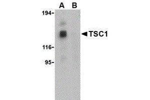 Western Blotting (WB) image for anti-Tuberous Sclerosis 1 (TSC1) (Center) antibody (ABIN2476985) (TSC1 anticorps  (Center))