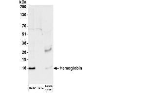 Western Blotting (WB) image for anti-Hemoglobin antibody (HRP) (ABIN7449503)